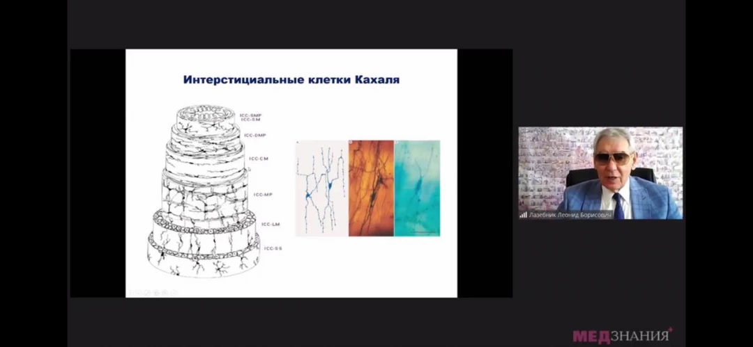 
                                                                             Медзнания.ВЕБИНАР. Поражения органов пищеварения при COVID-19 и возможные последствия при СРК
                                                                              