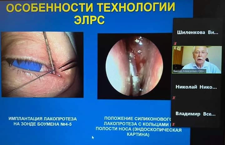 
                                                                             Медзнания.Вебинар 1 Ежегодной Конференции Российского Общества Ринологов. Дакриология детского возраста
                                                                              