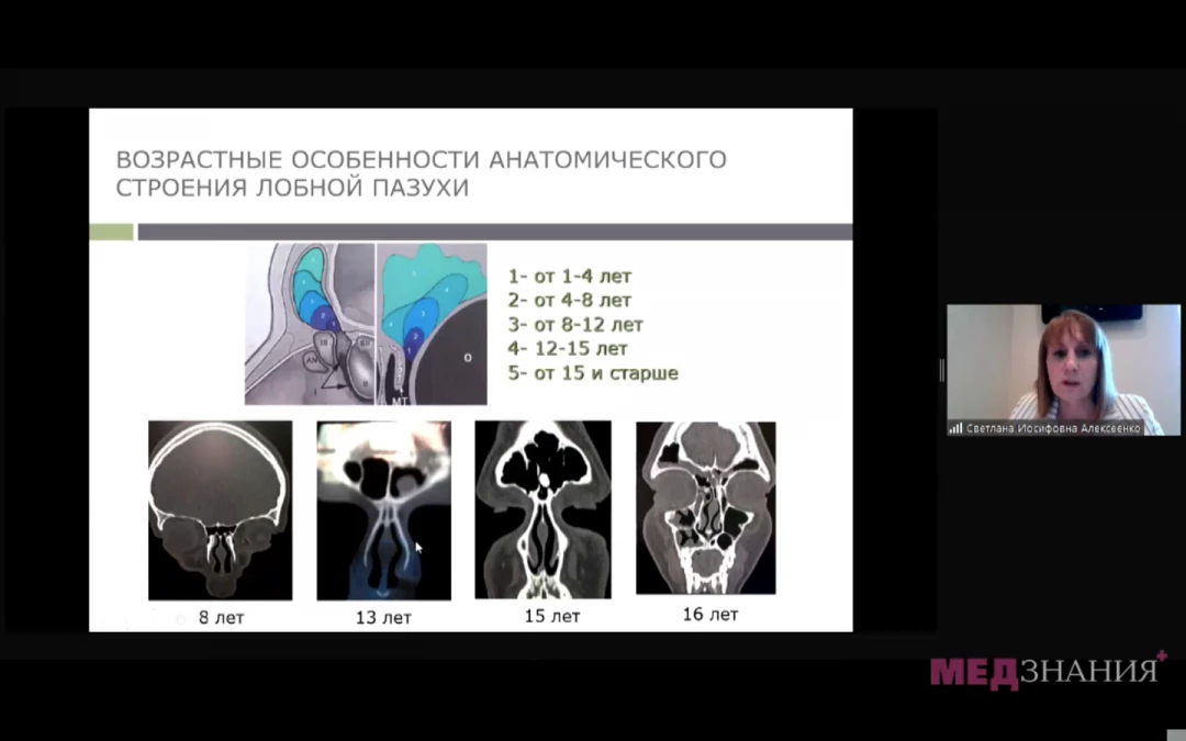 
                                                                             Медзнания.Вебинар 2 Ежегодной Конференции Российского Общества Ринологов. Многоликий риносинусит и детская ринология
                                                                              